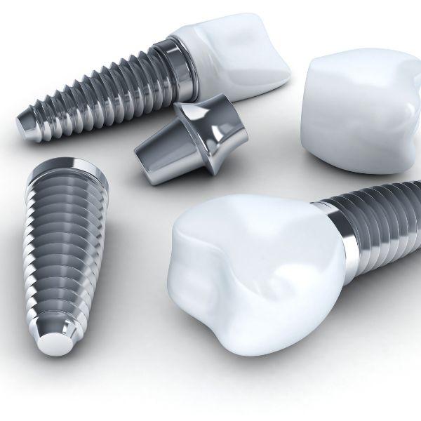 Dental implants review