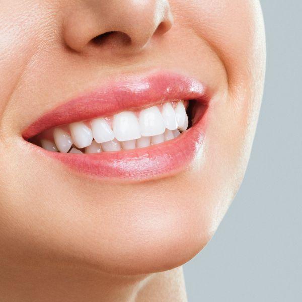 Teeth Whitening Reviews